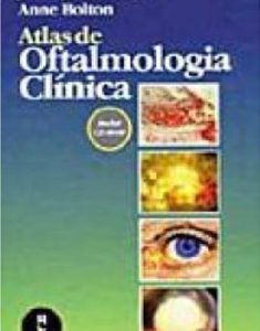 Nome Do Livro: Atlas de Oftalmologia Clínica Autor: JACK J. KANSKI e ANNE BOLTON Editor: Artmed